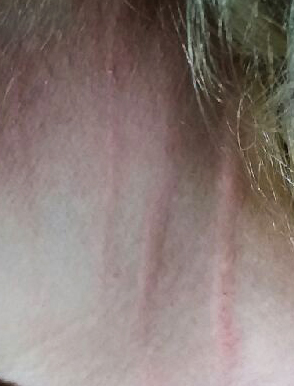 Scratches from Haunted Z Ward Asylum